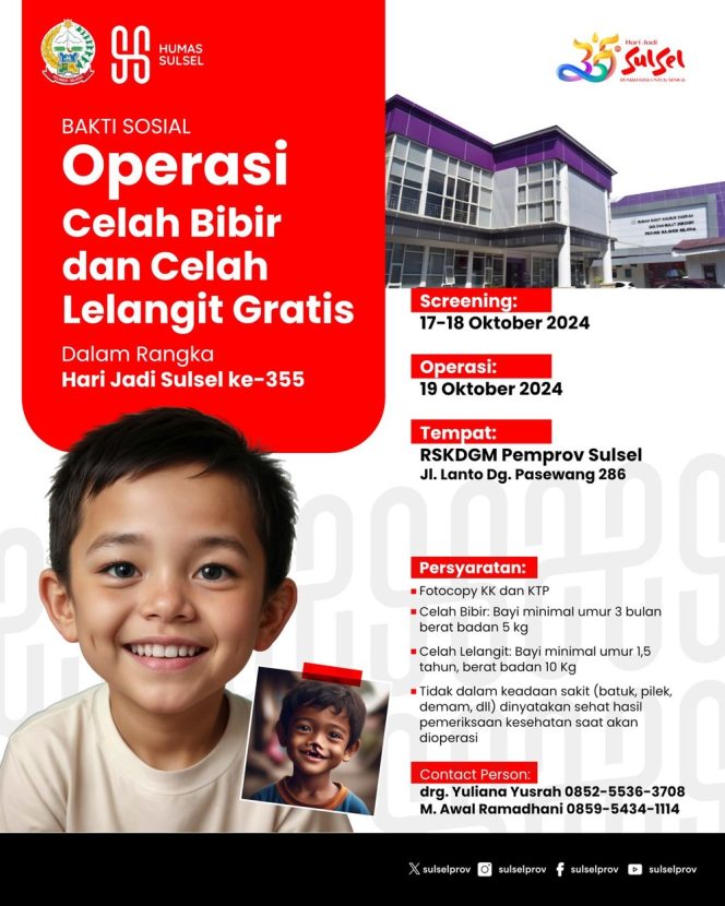 
 HUT ke-355 Sulsel, Pemprov Gelar Operasi Celah Bibir dan Celah Lelangit Gratis